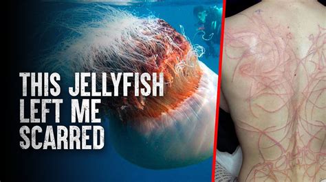 The Enigma Behind Dreaming of a Jellyfish Sting