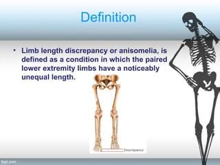 The Enigmatic Phenomenon: Unequal Length of Lower Limbs