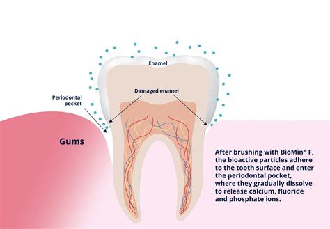 The Enigmatic Phenomenon of Dissolving Enamel in Dreams