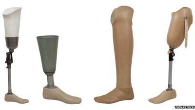 The Evolution of Artificial Limbs: From Rigid and Bulky to Dynamic and Responsive