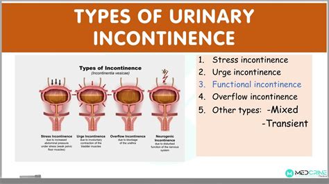 The Factors Influencing Dreams of Incontinence