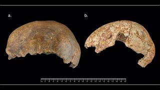 The Fascinating Journey of Acquiring Human Craniums: An Engaging Exploration into the World of Skull Collection