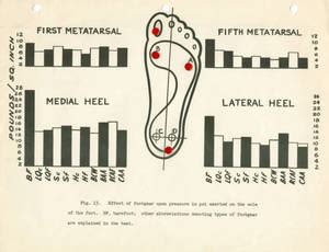 The Fascinating Phenomenon of Vanishing Footgear