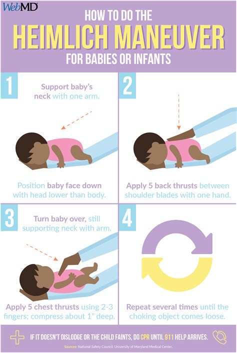 The Heimlich Maneuver Technique for Infants