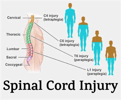 The Hidden Significance of Dreams Involving Injuries to the Spinal Cord