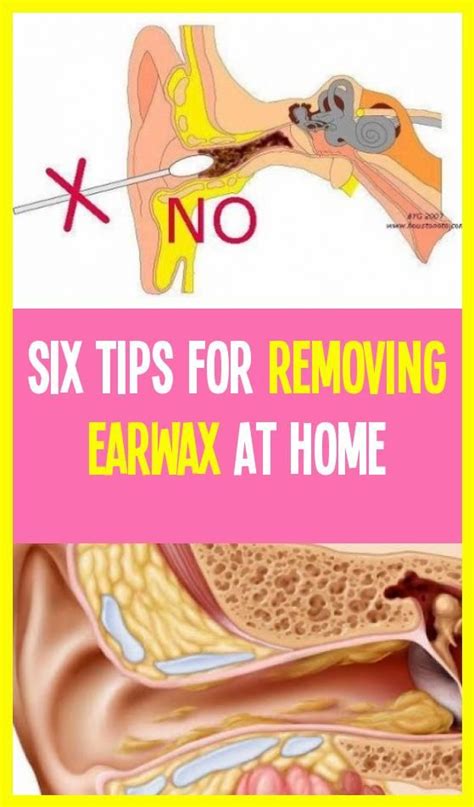 The Importance of Earwax: A Natural Protector