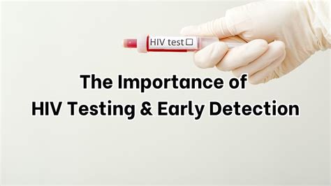 The Importance of HIV Testing in Early Detection and Treatment