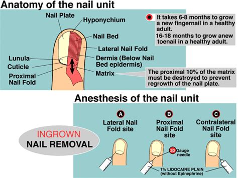 The Influence of Nail Extraction Dreams on Personal Connections