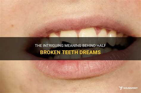 The Intriguing Fascination with Teeth in the Realm of Dreams