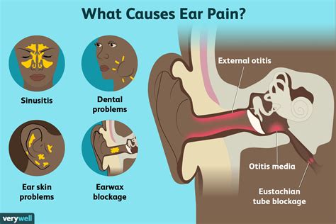 The Intriguing Phenomenon of Ear Discomfort during Sleep Imagery