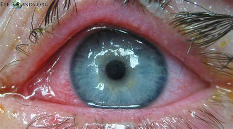 The Mysterious Origins and Historical Significance of Embroidered Ocular Orifices in Subconscious Manifestations