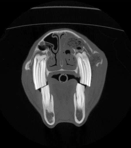 The Mysterious Vision: an Intriguing Experience of a Fragmented Oral Cavity