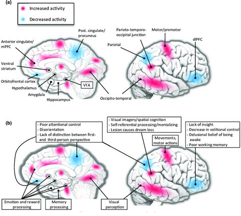 The Neuroscientific Perspective: Brain Activity During the Dreaming State