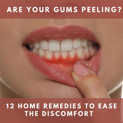 The Origins of Dreams about Gum Peeling: Unveiling the Triggers