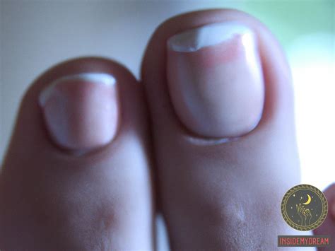 The Power and Enigma of Toenail Dreams