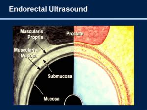 The Power of Ultrasound: Peering into the Unconscious