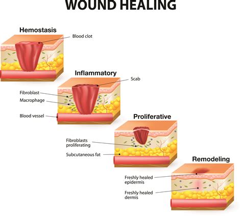 The Process of Healing Injuries: An Overview