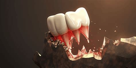 The Psychological Analysis of Bloodied Teeth in Dreamscapes