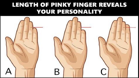 The Psychological Analysis of Pinky Finger Loss in Dreams