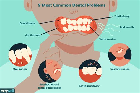 The Psychological Factors Behind Dreams related to Dental Degradation