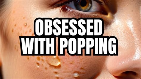 The Psychological Fascination Behind Pimple Popping