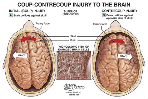 The Psychological Interpretation: Unraveling the Significance of an Injury on the Forehead