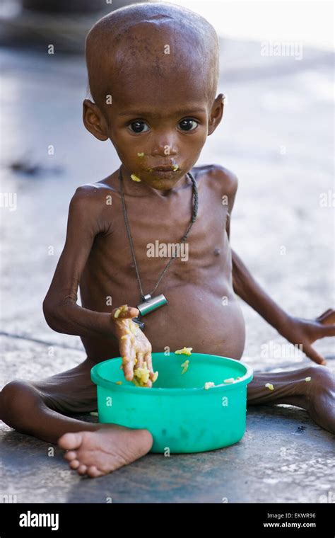 The Puzzle of a Starving Infant