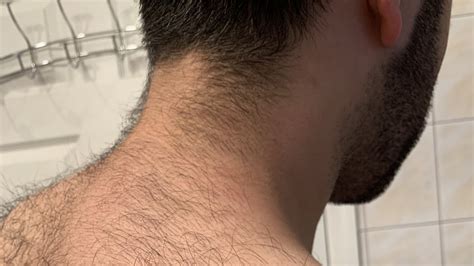 The Relationship Between Body Image and Dreaming About a Hairy Neck