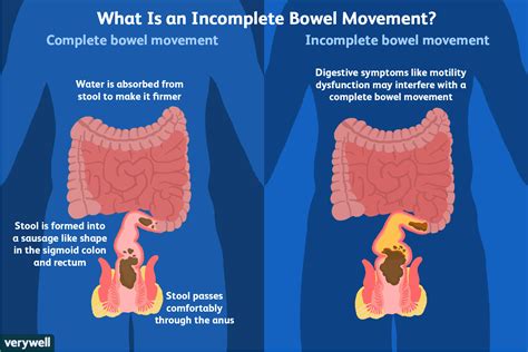 The Relationship Between Dreams of Bowel Movements and the Digestive Process