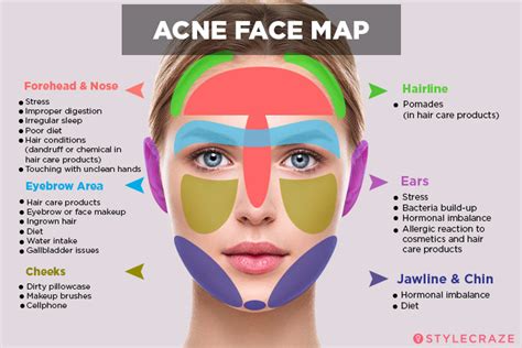 The Relationship between Stress and the Appearance of Acne on the Dermal Region