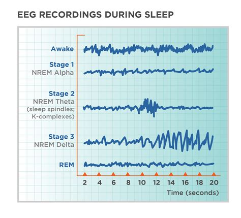 The Role of Brain Activity in Detecting Pretended Sleep Patterns