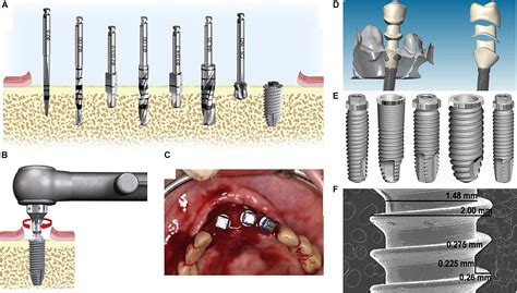 The Science Behind Metallic Teeth in Dreams: Fact or Fiction?