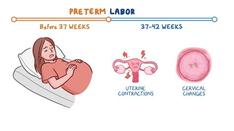 The Significance of Dreams About Preterm Delivery During Gestation