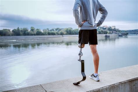 The Significance of Personalization in Artificial Limbs