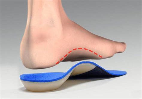 The Significance of Proper Arch Support in Footwear