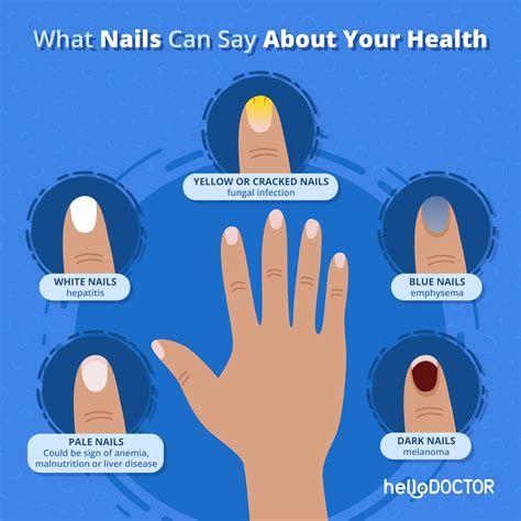 The Significance of Proper Nail Maintenance