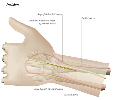 The Significance of the Right Wrist