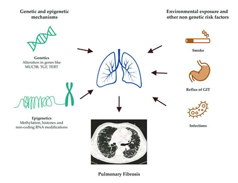 The Silent Killer: Unraveling the Factors behind the Development of Pulmonary Malignancy