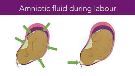 The Symbolic Meaning Behind the Rupture of Amniotic Fluid During the Maternal Journey