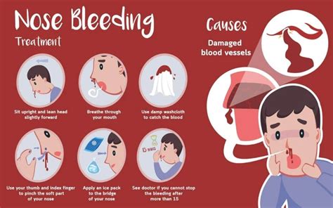 The Symbolic Meanings of Bleeding from the Nose in Dreams