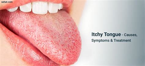 The Unexpected Reasons Behind an Achy Tongue