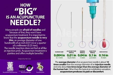 The Various Incarnations of Needle Dreams: From Sewing Needles to Acupuncture Needles