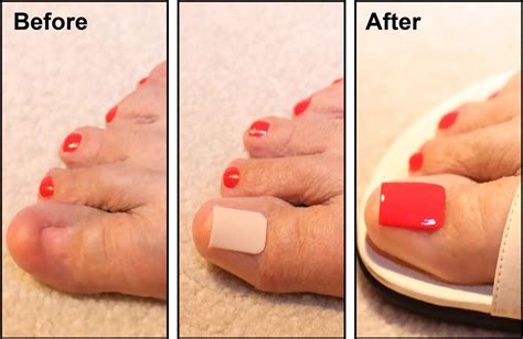 Tips to Avoid Nightmares about Damaged Foot Nails