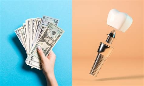 Tooth Implant Costs: Understanding the Financial Investment