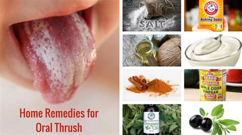 Treating Oral Inflammation: Natural Remedies