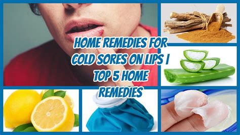 Treating and Preventing Cold Sores: Essential Steps for Lip Health