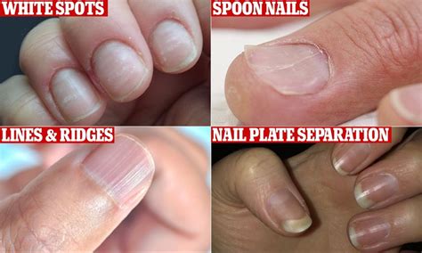 Troubleshooting Common Nail Clipping Issues: Expert Solutions for Nail Care Problems