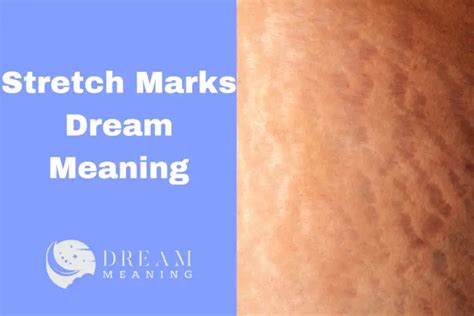 Uncovering the Enigmatic Significance of Chest Marks in Dream