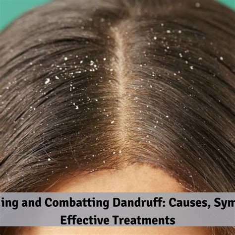 Understanding Dandruff: Causes and Symptoms