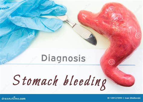 Understanding Stomach Bleeding: A Brief Overview